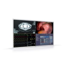Barco MDSC-8255 computer monitor 139.7 cm (55') 3840 x 2160 pixels 4K Ultra HD LCD White
