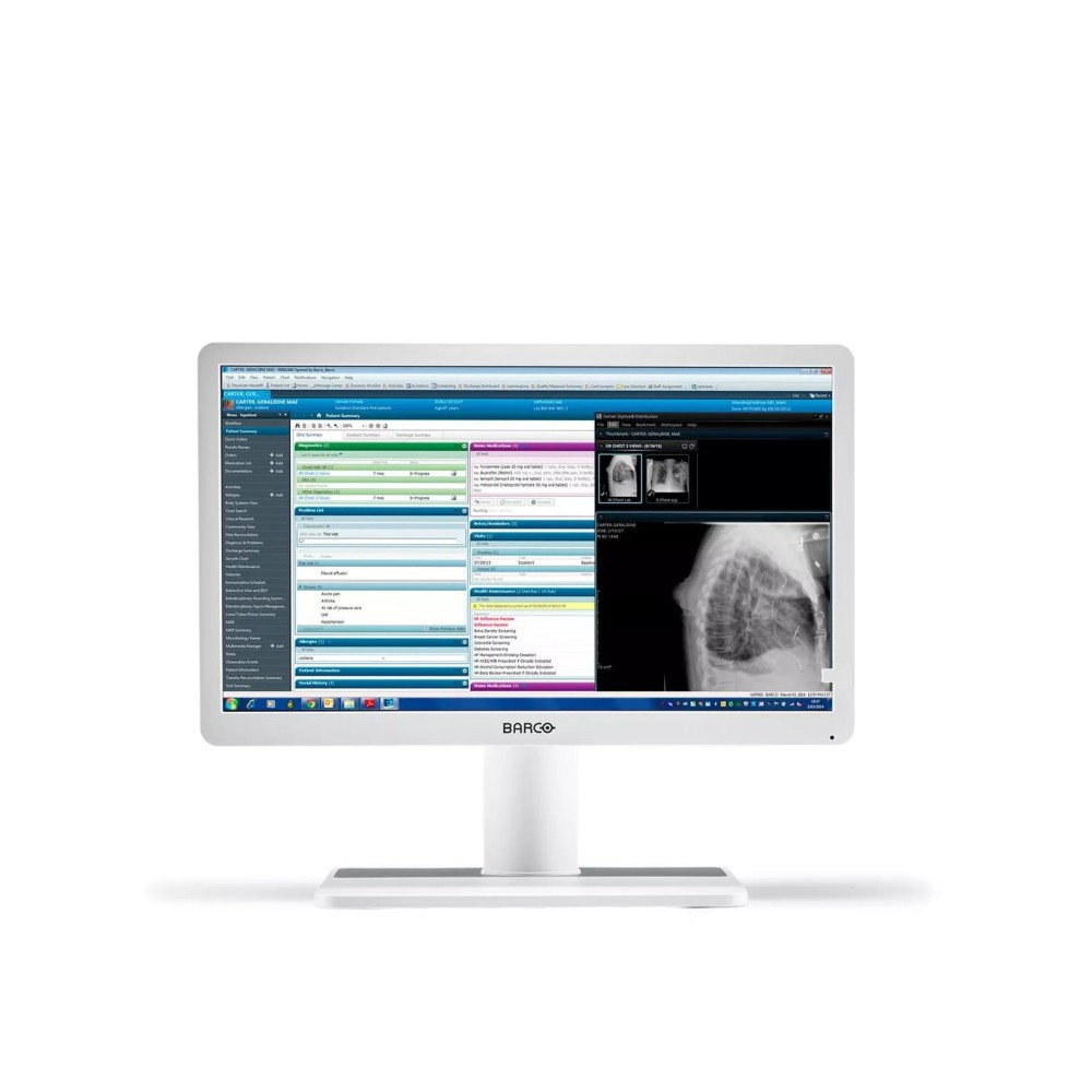 Barco MDRC‑2222 computer monitor 54.6 cm (21.5') 1920 x 1080 pixels Full HD LCD White