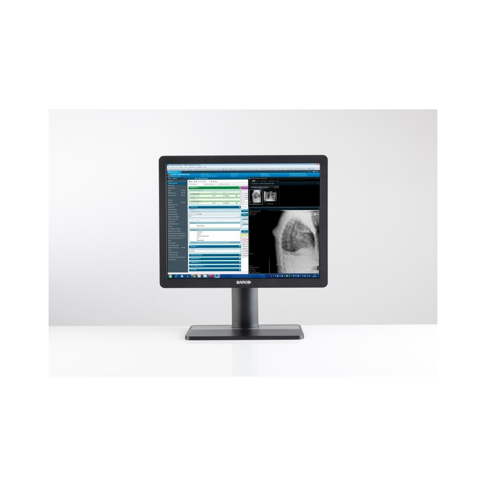 Barco Eonis computer monitor 54.1 cm (21.3') 1600 x 1200 pixels HD LCD Black