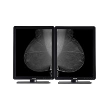 Barco Nio 5MP LED (MDNG-5221) LED display 54.1 cm (21.3') 2560 x 2048 pixels 2K Ultra HD Black, White