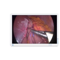 Barco AMM240ED computer monitor 61.1 cm (24.1') 1920 x 1200 pixels Full HD LED White